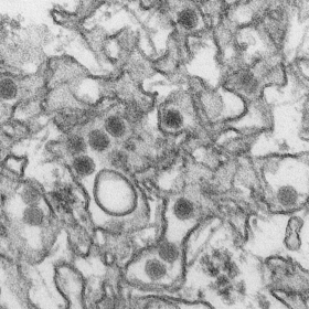 Micrografia eletrônica do vírus Zika. As partículas virais têm cerca de 40 nm de diâmetro, com um núcleo denso e cápsula exterior. (fonte: CDC)