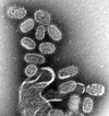 Electron microscopy image of negatively stained influenza virons