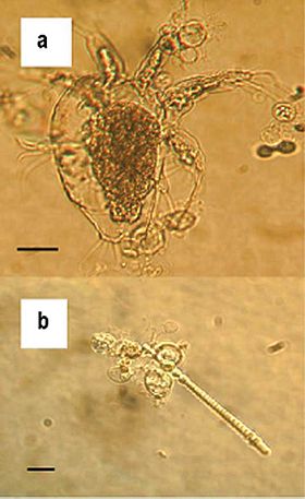 Zoosporangia de B. dendrobatidis crescendo em artrópodes de água doce (a) e algas (b); barras de escala = 30 µm