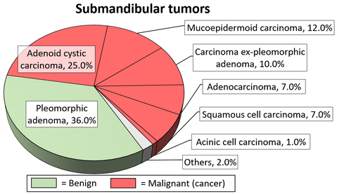 Relative incidence of submandibular tumors.[15]