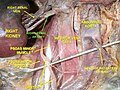 Renal artery