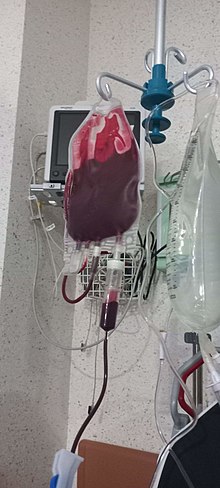 Bolsa de sangre durante un procedimiento de transfusión sanguínea