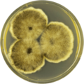 Aspergillus brunneoviolaceus growing on CYA plate