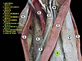 Vastus medialis muscle