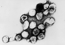 Transmission electron micrograph of Rubella virus virions