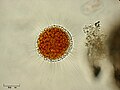 Vampyrella sp. (Cercozoa : Vampyrellidae)