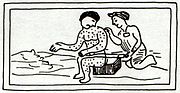 16th-century Aztec print showing a person with measles