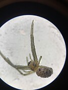 Juvenile Female Under Dissecting Microscope - Cairo, Egypt