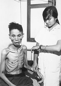 Starved Vietnamese man, by the United States Information Agency (restored by Chris Woodrich)