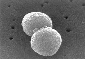 Клетки S. pneumoniae под электронным микроскопом