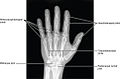 X-ray showing joints