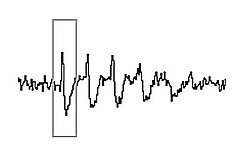 A jagged line with upward-downward deflections. A rectangular box surrounds one deflection.