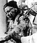 22-year old victim Toyoko Kugata being treated at the Hiroshima Red Cross Hospital (6 October 1945)