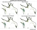 Schémas quantifiant l'hyperhidrose axillaire.