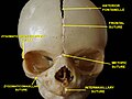 Skull of newborn. Anterior view.