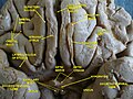 Cerebrum. Optic and olfactory nerves. Inferior view. Deep dissection.