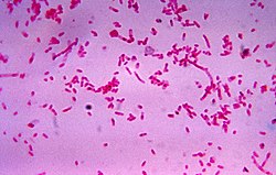 Fusobacterium novum в рідкій культурі