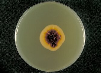 Bottom view of a Sabouraud agar plate with a colony of Trichophyton rubrum var. rodhaini