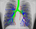 Human chest radiographic anatomy.