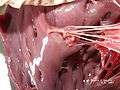 Papillary muscles and chordae tendineae