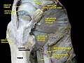 Obturator externus muscle. Deep dissection. Anterior view.