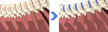 Lumbar area vertebrae before and after lumbar traction procedure