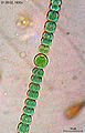 Anabaena sperica (Eubacteria)