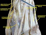 Muscles of hand. Posterior view.