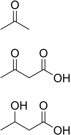 Ketone bodies.png