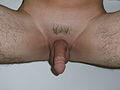 Male genitalia with partly shaved pubic hair