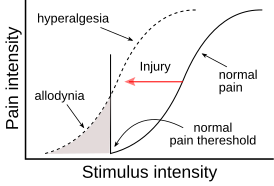 Гипералгезия и аллодиния