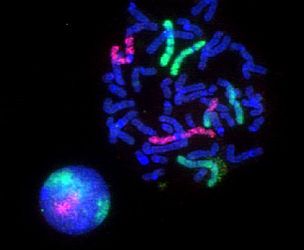 Fluorescence microscopy images of sun flares pathology in a blood cell showing the affected areas in red.