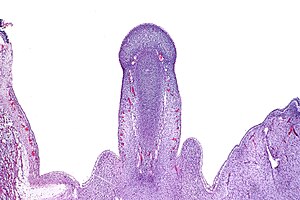 Micrograph of the primordial phallus, H&E stain.