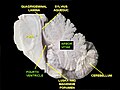 Midsagittal section of the brainstem. Arbor vitae labelled at the center.