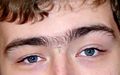A young adult with hair between the eyebrows - a unibrow