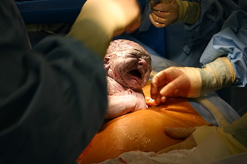 First Breath by Matt Burtchaell. The first breath of a child being born by Caesarean section.