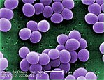 Staphylococcus aureus i 20 000x förstoring.