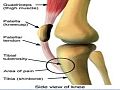 تشريح الركبة. أحدوبة الظنبوب (tibial Tuberosity).