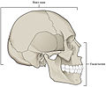 Facial bones and neurocranium (labeled as "Brain case").