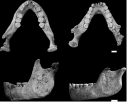 Mandíbula e dentes do Homo floresiensis.