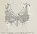 Corselet-gorge de Mme Cadolle.