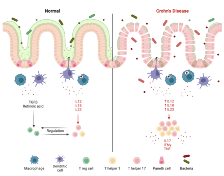 diagram of mechanism of Crohn's disease