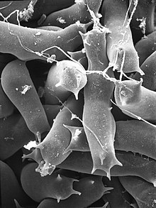 Electromicrograph of Lobosporangium transversalis