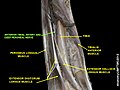 Deep fibular nerve