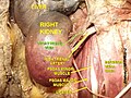 Renal artery