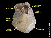 An anatomical specimen of the heart
