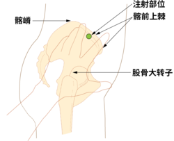 股臀肌注射區域