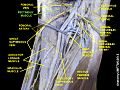 Pectineus muscle