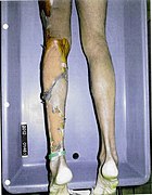 Autopsy photo of Rainey’s legs.