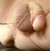 Perineal and scrotal raphe
